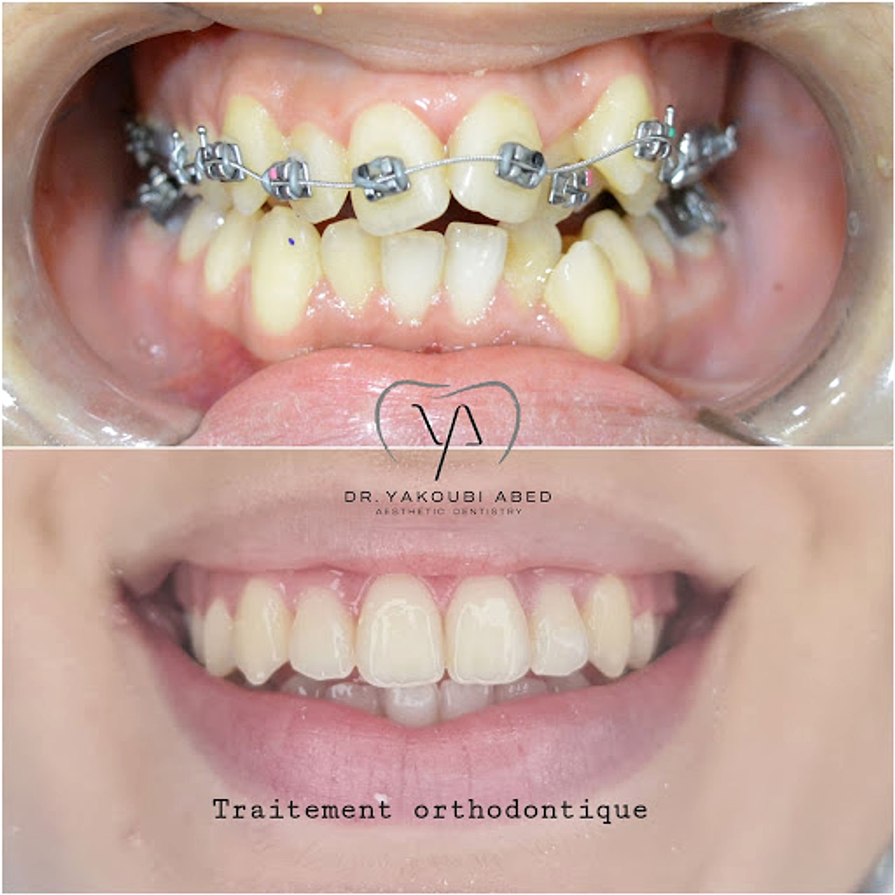 Orthodontie